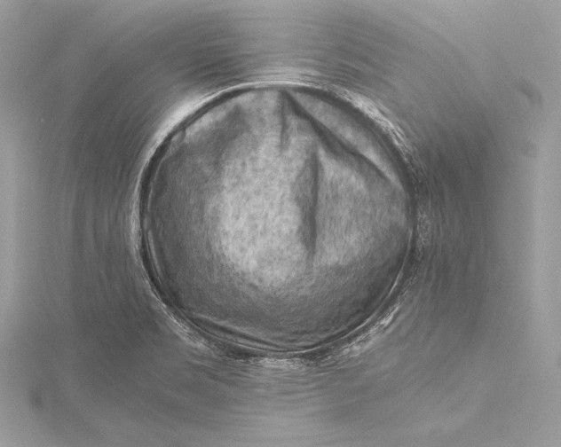 X0000115801469200912041523