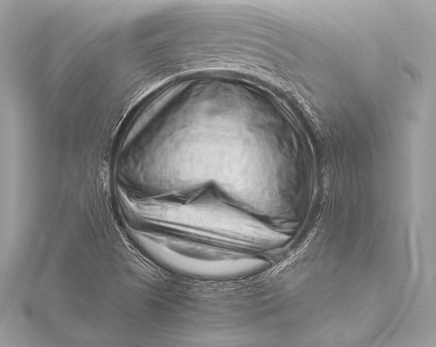 X0000115801505200912041523