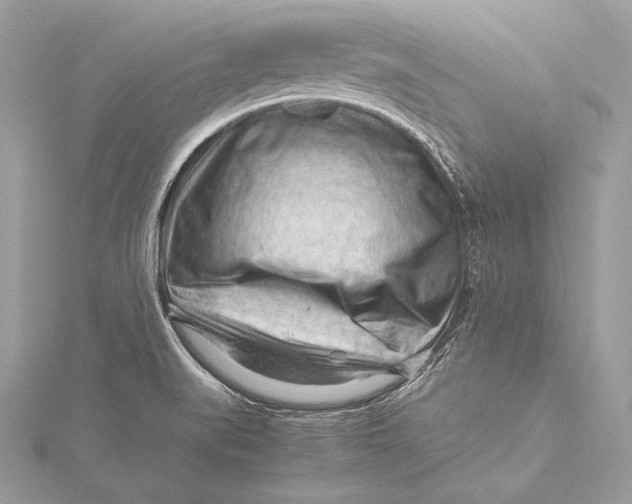 X0000115801519200912041523