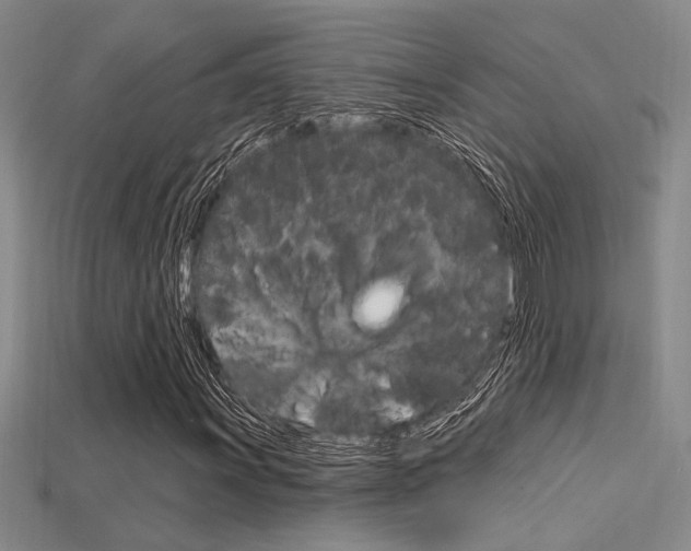 X0000115811011200911131038