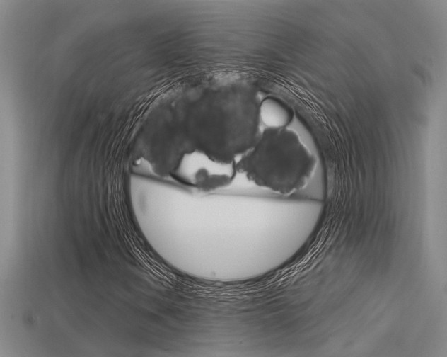 X0000115811106200911131037
