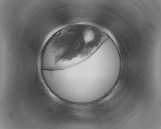 X0000115811149200911131037