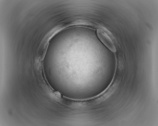 X0000115811369200911131412