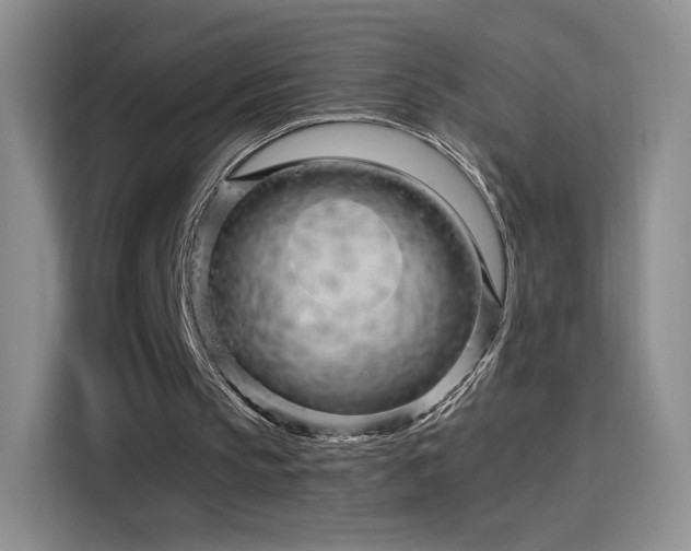 X0000115810145200911201425