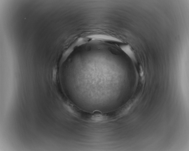 X0000115810231200911201425