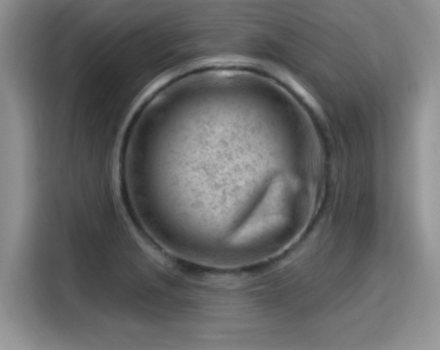 X0000115811229200911201411