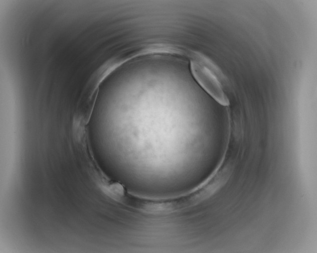 X0000115811369200911201410