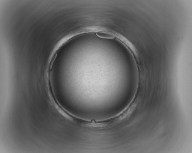 X0000115811381200911201409