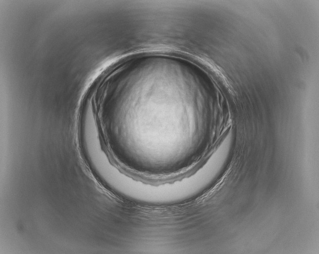 X0000115811414200912041557