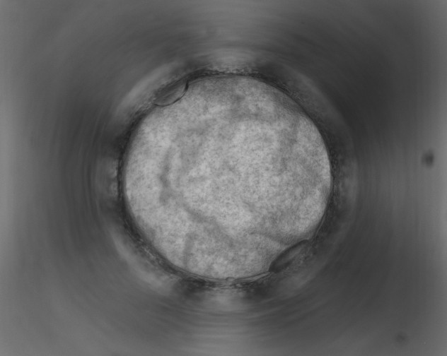 X0000115810696200912241914