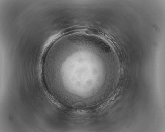 X0000115820149200911131451