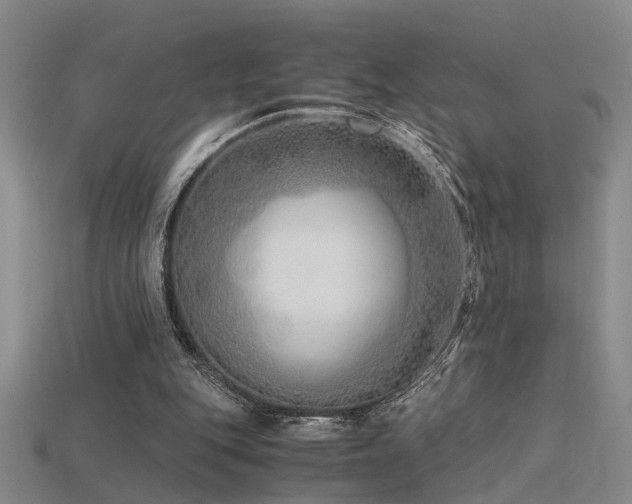 X0000115820151200911131451