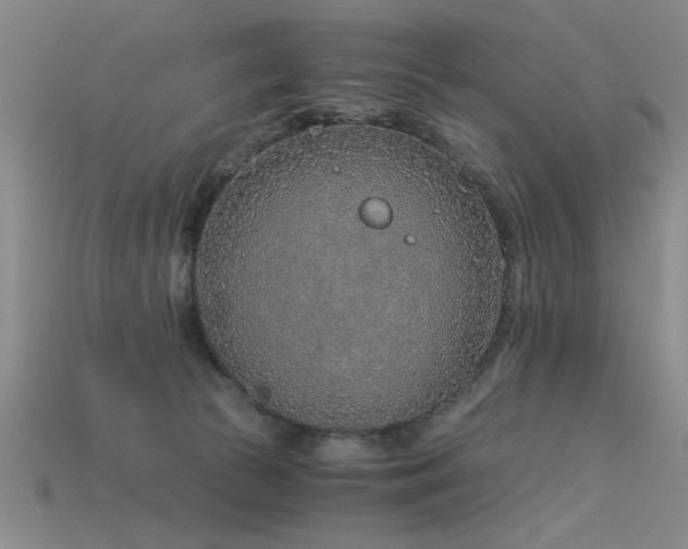 X0000115820177200911131452