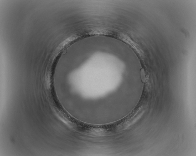 X0000115820203200911131451