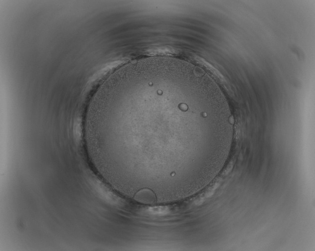 X0000115820353200911131449