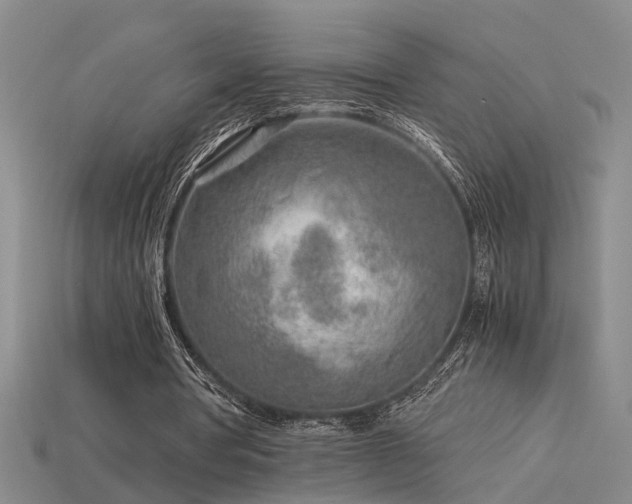 X0000115820386200911131449