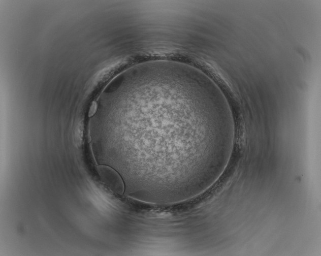 X0000115820640200911131445