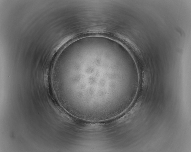 X0000115821162200911131438