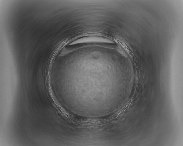 X0000115820145200911201452