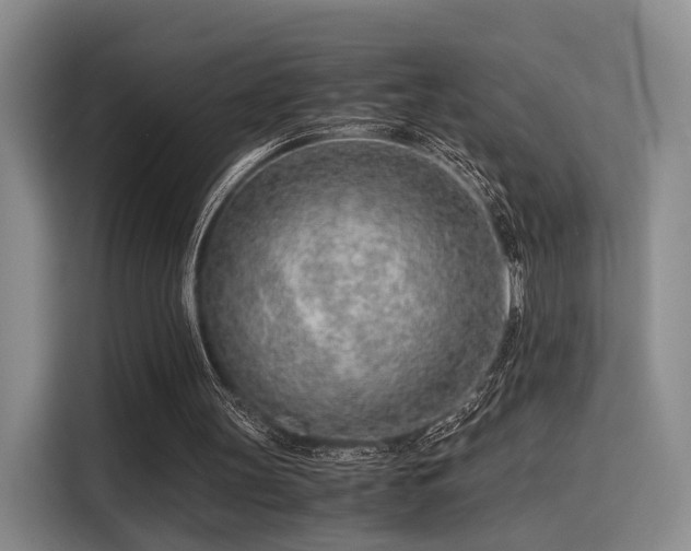 X0000115820147200911201452