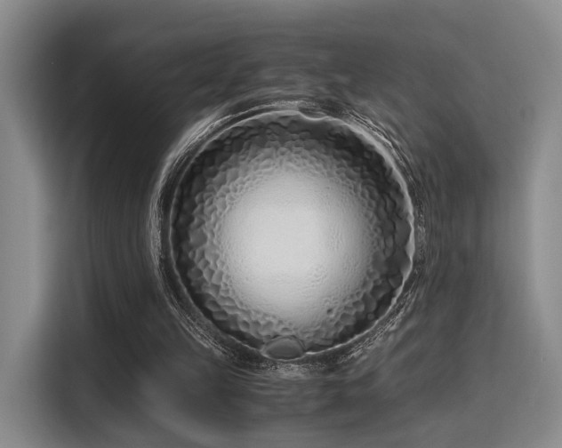 X0000115820149200911201452