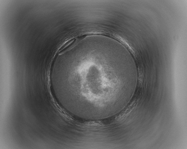 X0000115820386200911201449