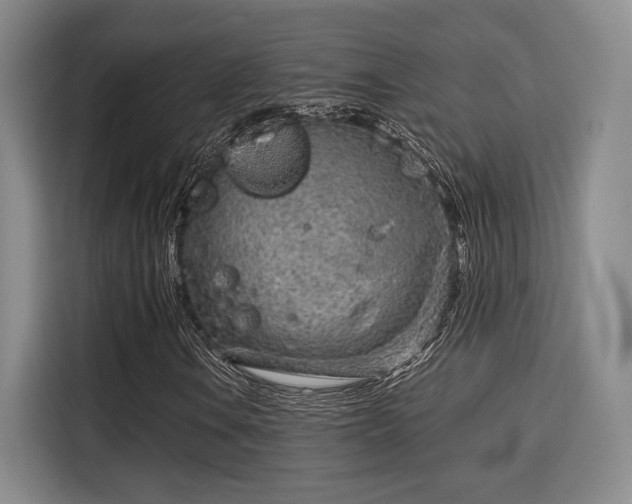 X0000115821106200911201439