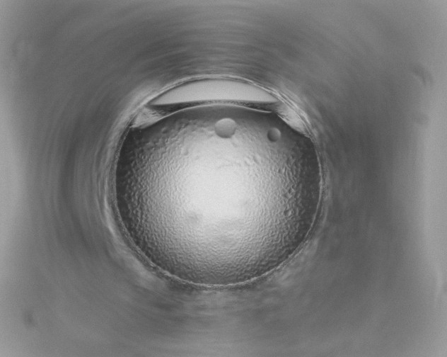 X0000115820145200911271145