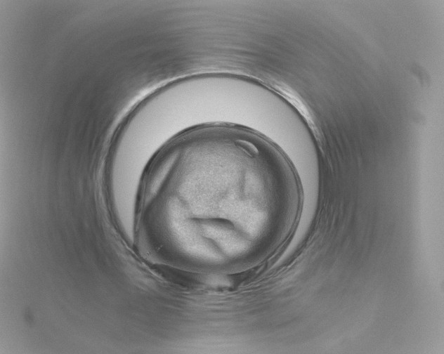 X0000115820387200911271142