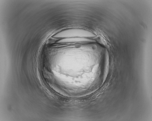 X0000115820145200912041634