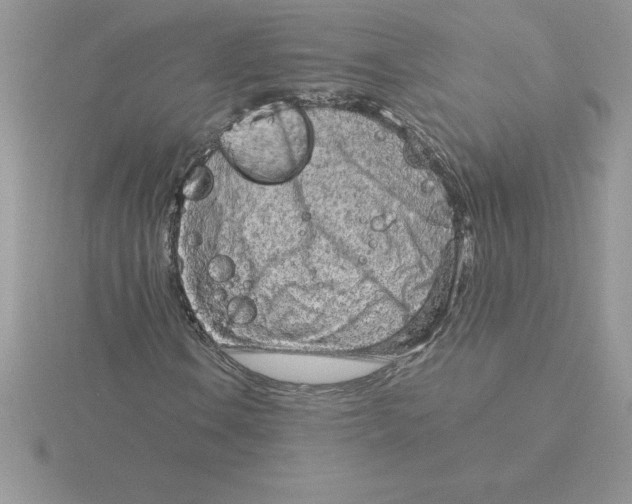 X0000115821106200912111245