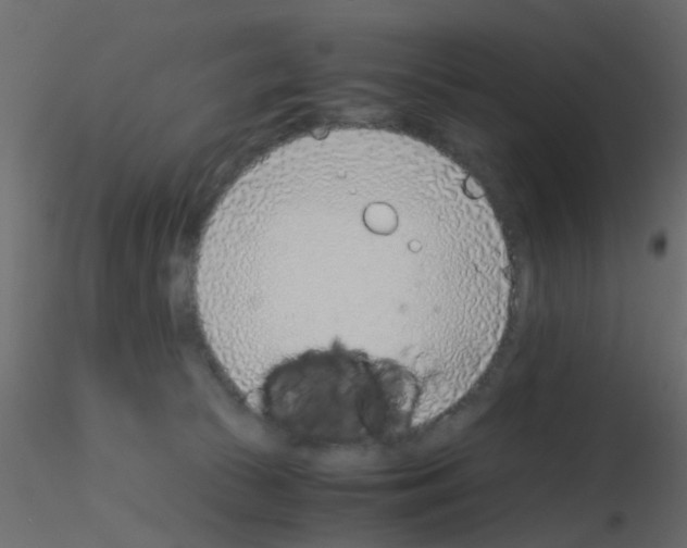 X0000115820177200912241942