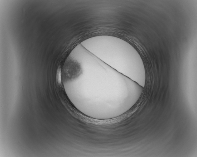 X0000115840046200911131115