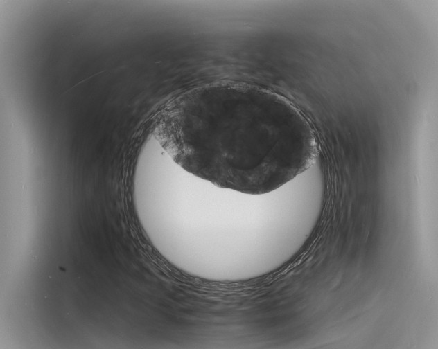 X0000115841205200911131059