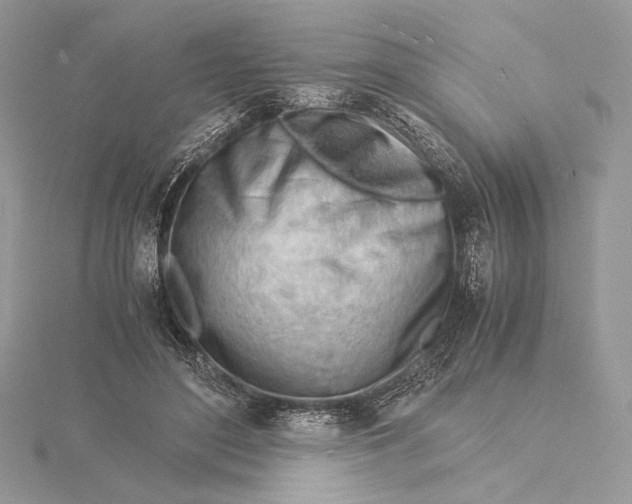 X0000115840500200912041711