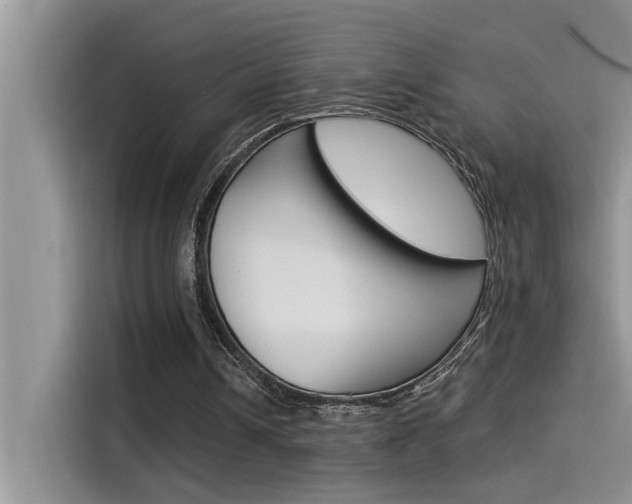 X0000115850242200911131132