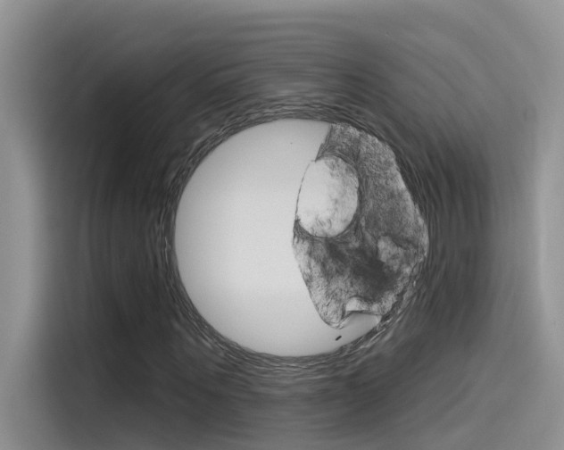 X0000115850867200911131124
