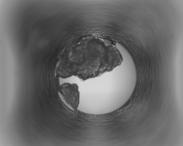 X0000115851106200911131121