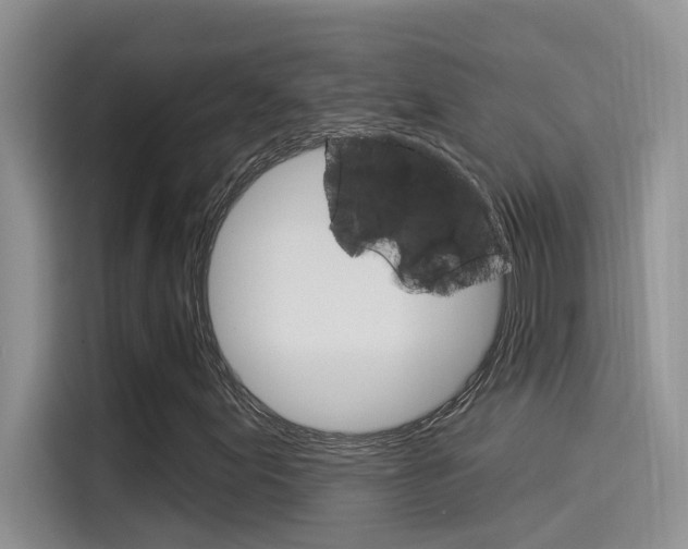 X0000115851155200911131121
