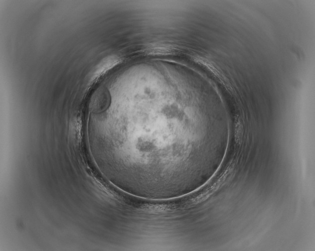 X0000115851402200911131542