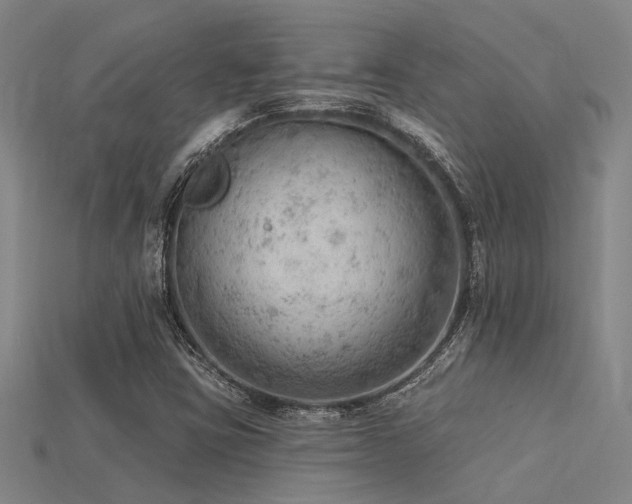 X0000115851403200911131542