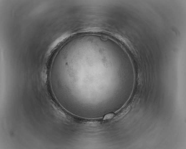 X0000115851406200911131542