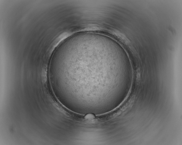 X0000115851409200911131542