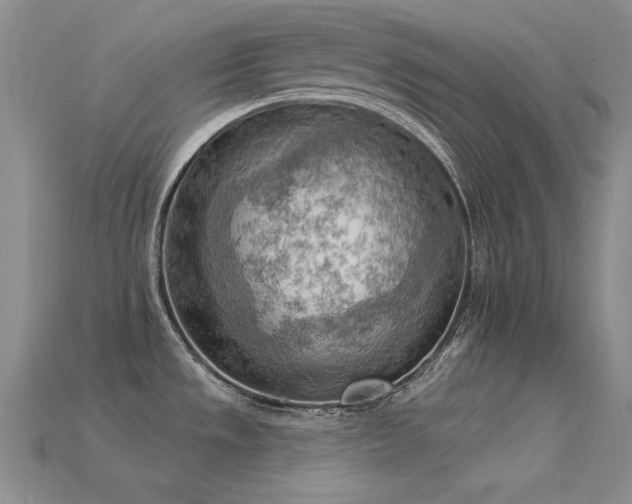 X0000115851533200911131541