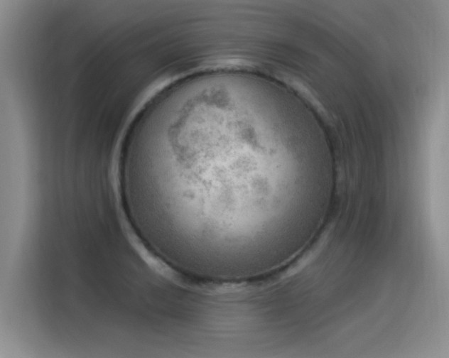 X0000115851038200911201609