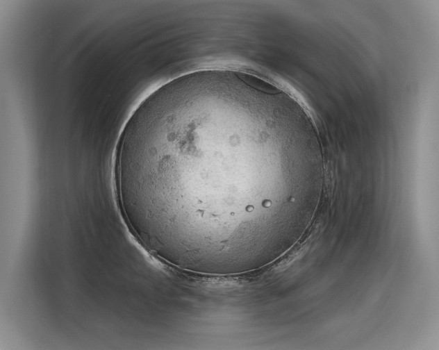 X0000115851103200911201608