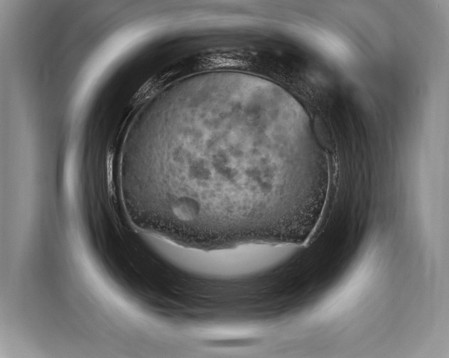 X0000115851439200911201604