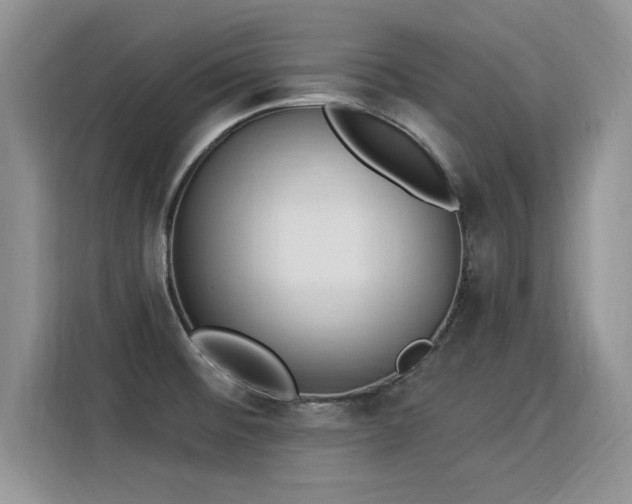 X0000115851476200911201603
