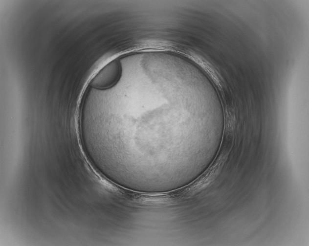 X0000115851486200911201603