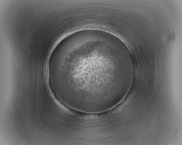 X0000115851515200911201603